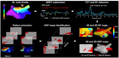 Automatic Extraction of Recurrent Patterns of High Dominant Frequency Mapping During Human Persistent Atrial Fibrillation